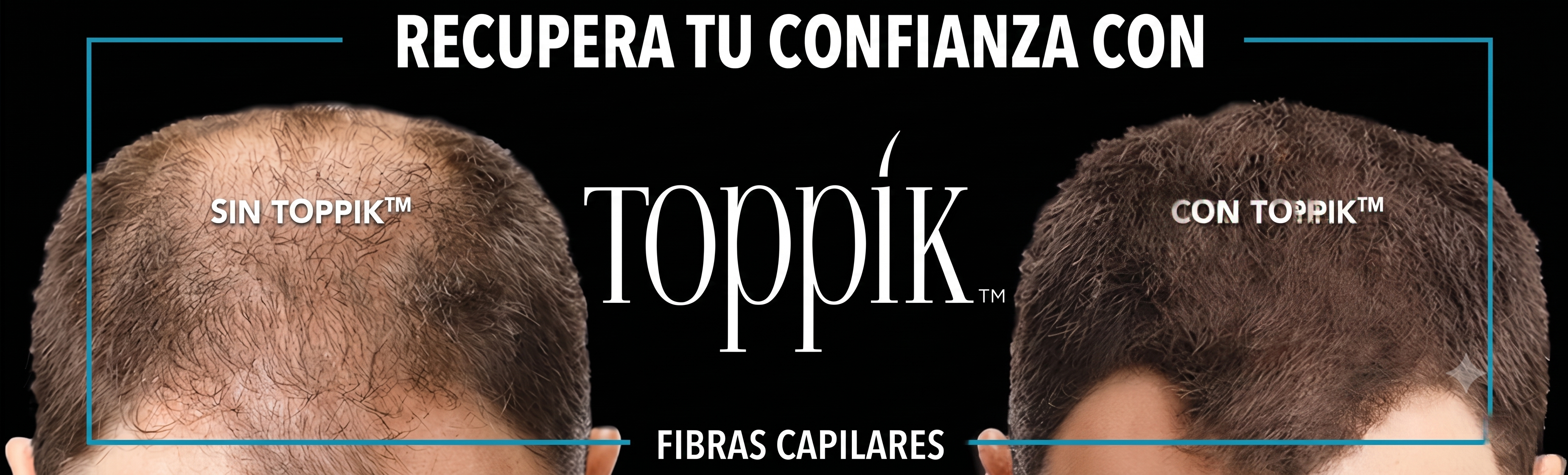 TOPPIK